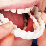Snap On Smile Braces (Premium Quality)