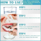 Snap On Smile Braces (Premium Quality)