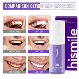 HiSmile V34™ – No More Yellow Stains, Just Bright Smiles