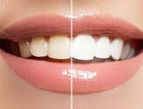 HiSmile V34™ – No More Yellow Stains, Just Bright Smiles
