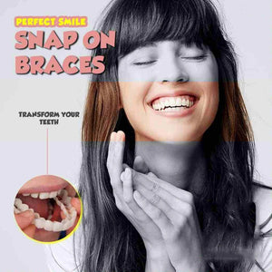 Snap On Smile Braces (Premium Quality)